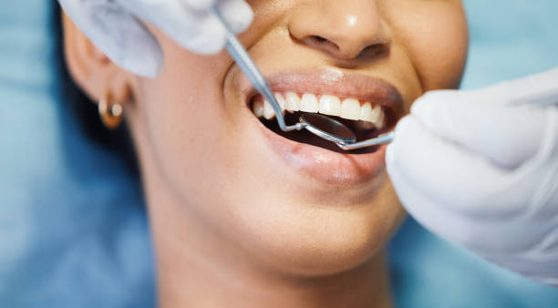 Best Emergency Treatment for Dental Infections or Abscesses in Chillicothe, MO